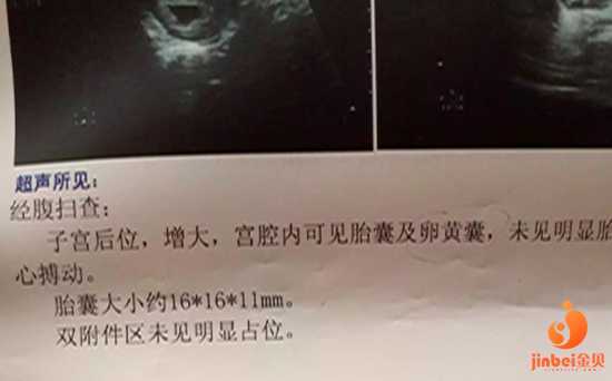 北京合肥试管婴儿供卵_【卵巢早衰可以做供卵试管吗】果真的入睡困难，也不